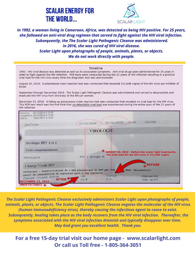 HIV PCR Test result