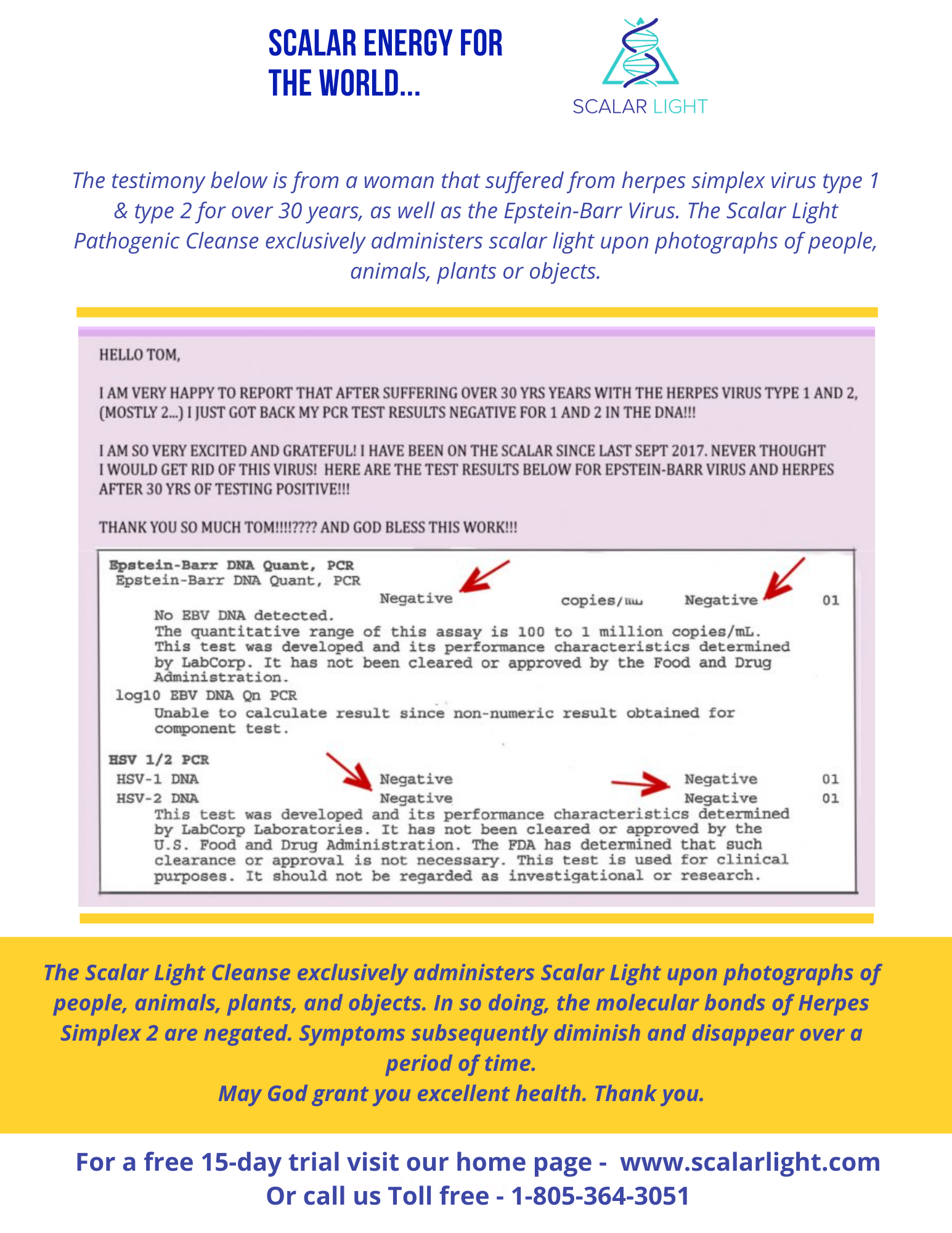 Epstein Barr Virus PCR Test result