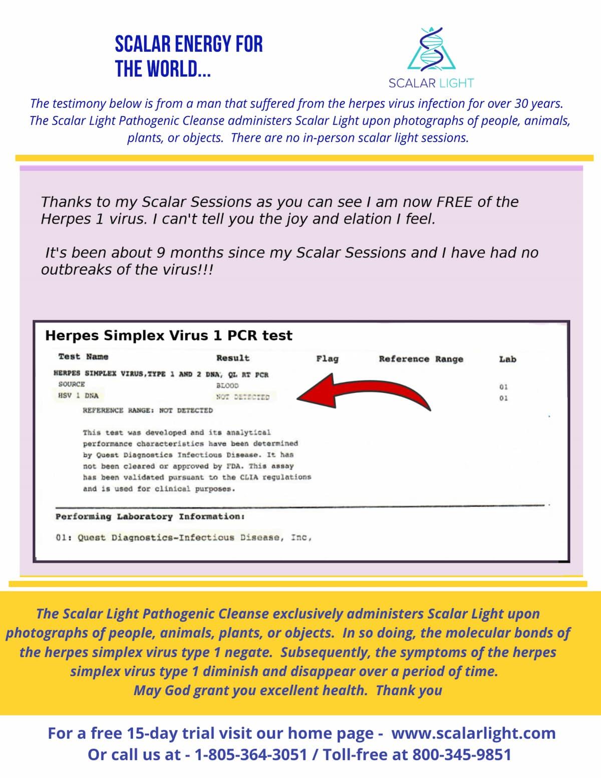 Herpes PCR test result