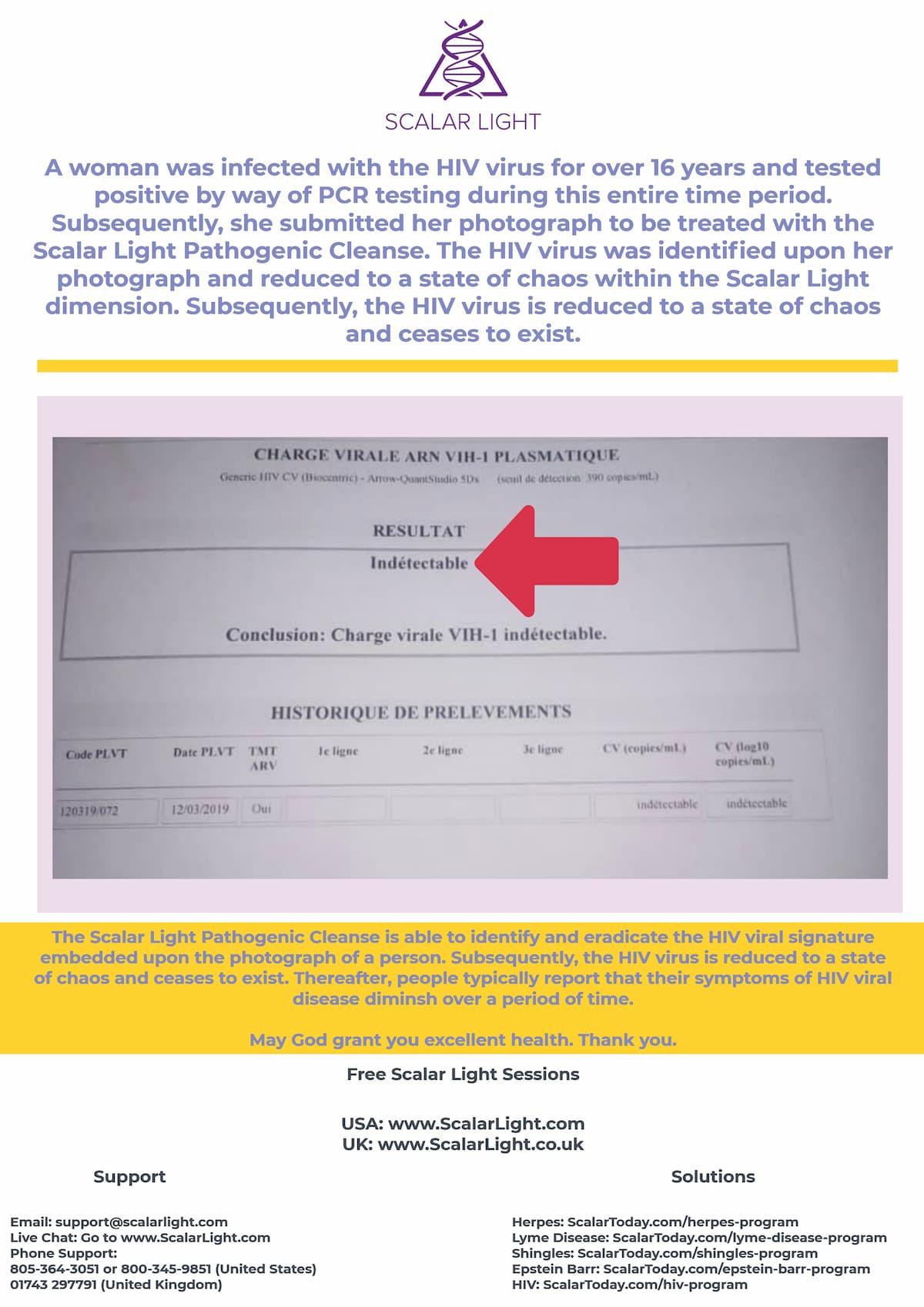 HIV PCR test result