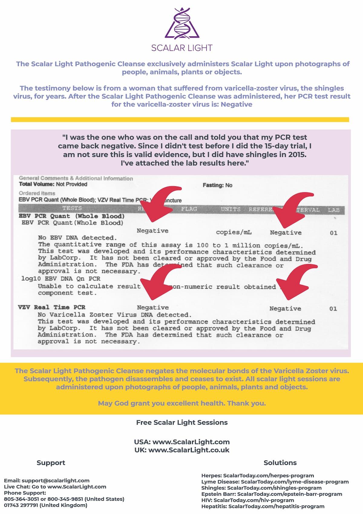 Shingles PCR Test Result